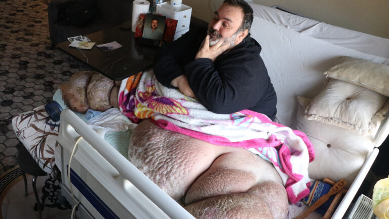kayseride-fil-hastasi-adam-300-kiloya-ulasti-5-yildir-disari-cikamiyor-pbnNyn81.jpg